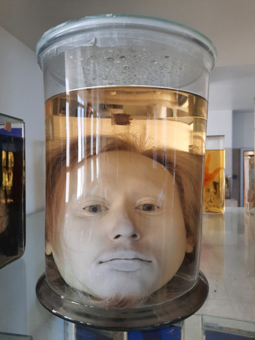 real human head preserved in jar
