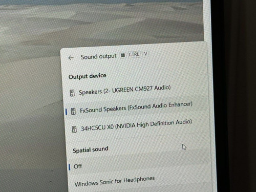 ugreen 2k webcam microphone s 1778386148 27086b6a progressive